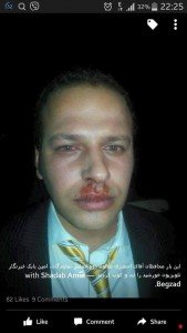 یک خبرنگار در کابل لت و کوب شد_n