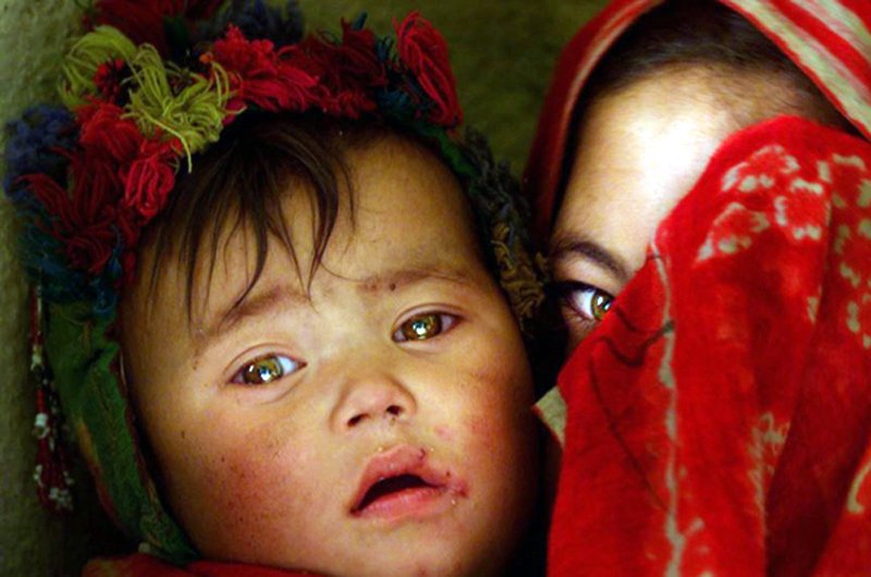 کارزار واکسین سرخکان در غور نیز به تاخیر افتاده