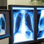 اهدای دستگاه رادیولوژی برای تداوی بیماری سرطان از سوی سازمان ملل