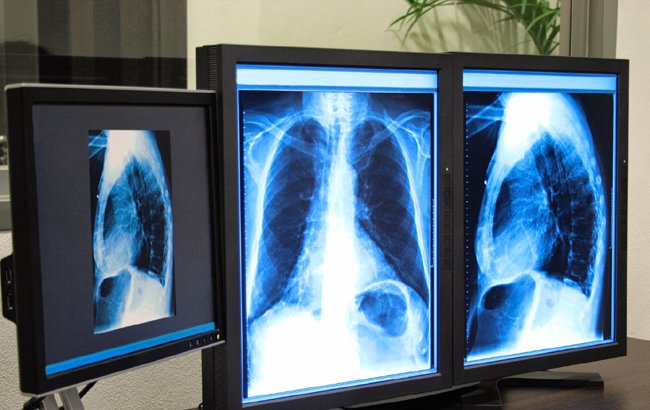 اهدای دستگاه رادیولوژی برای تداوی بیماری سرطان از سوی سازمان ملل