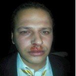 یک خبرنگار در کابل لت و کوب شد