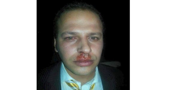 یک خبرنگار در کابل لت و کوب شد