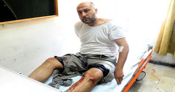 دمشق زیر آتش بمب و موشک