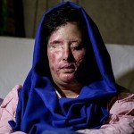 دستگیری متهم احتمالی اسیدپاشی در اصفهان