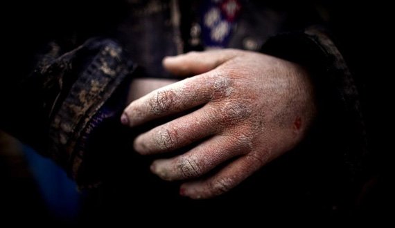 تجاوز جنسی به پسر ۴ ساله‌ای در هرات
