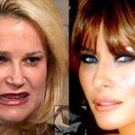 همسران ترامپ و تدکروز بازی انتخاباتی شدند