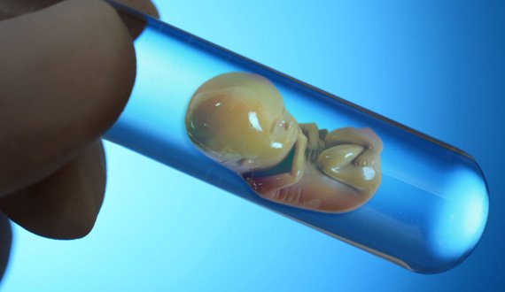 دانشمندان روسیه موفق به ساخت مغز در شرایط آزمایشگاهی شدند