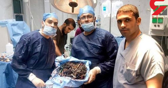 با زن مصری آشنا شوید که سیم ظرف‌شویی خورده است