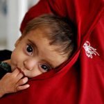 ۳۰ درصد کودکان روستایی در هرات با سوء تغذیه دست و پنجه نرم می‌نمایند