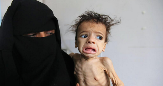 یک میلیارد دالر برای مردم یمن کمک جمع آوری شد