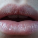 درمان‌های خانگی طبیعی برای ترک لب‌ها را یاد بگیرید!