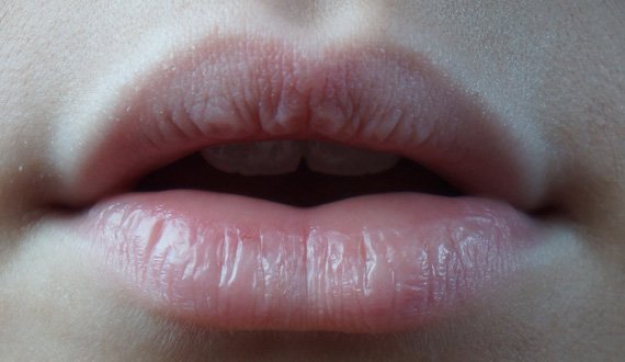 درمان‌های خانگی طبیعی برای ترک لب‌ها را یاد بگیرید!