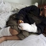 افزایش ۲۱ درصدی تلفات کودکان در افغانستان