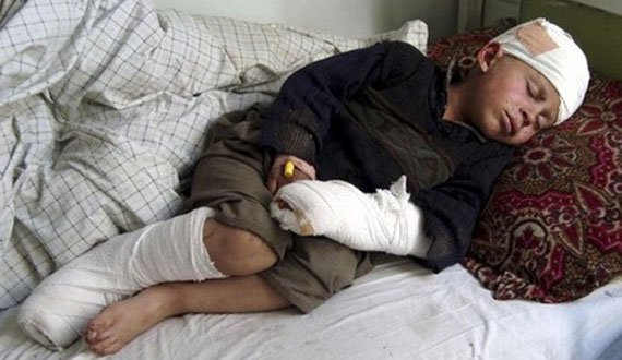 افزایش ۲۱ درصدی تلفات کودکان در افغانستان