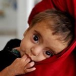 شمار بیماران سوء تغذیه در هرات کاهش یافته است
